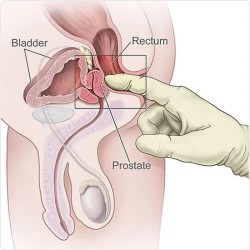 Cock Ring Prostate Massager